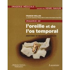  IMAGERIE DE L'OREILLE ET DE L'OS TEMPORAL. TOME 1, ANATOMIE ET IMAGERIE NORMALES, Veillon Francis